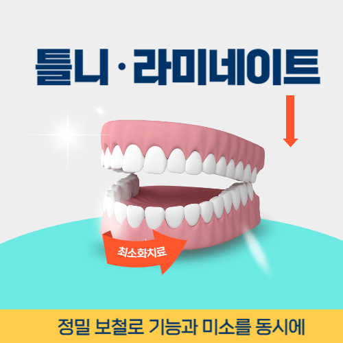 대전치과 대전광역시 치과 틀니 라미네이트