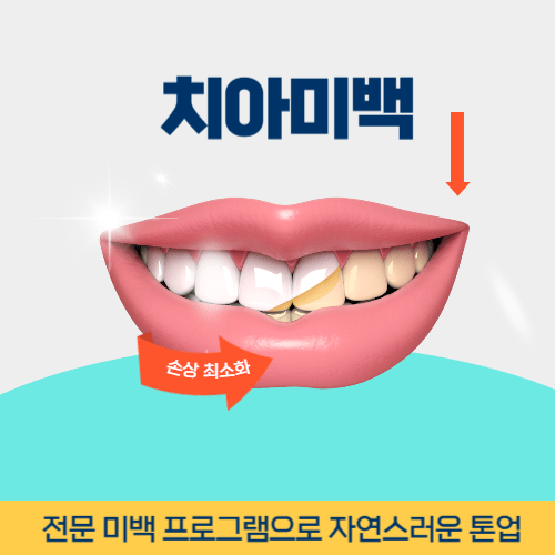 대전치과 대전광역시 치과 치아미백