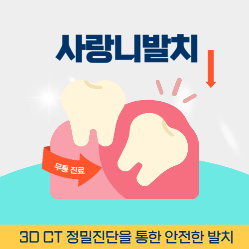 대전치과 대전광역시 치과 사랑니 발치