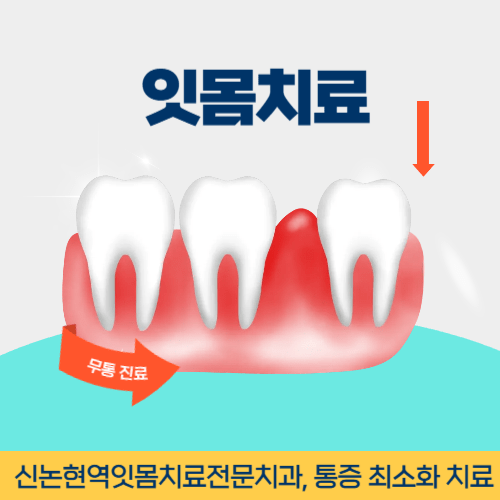 대전치과 대전광역시 치과 잇몸치료